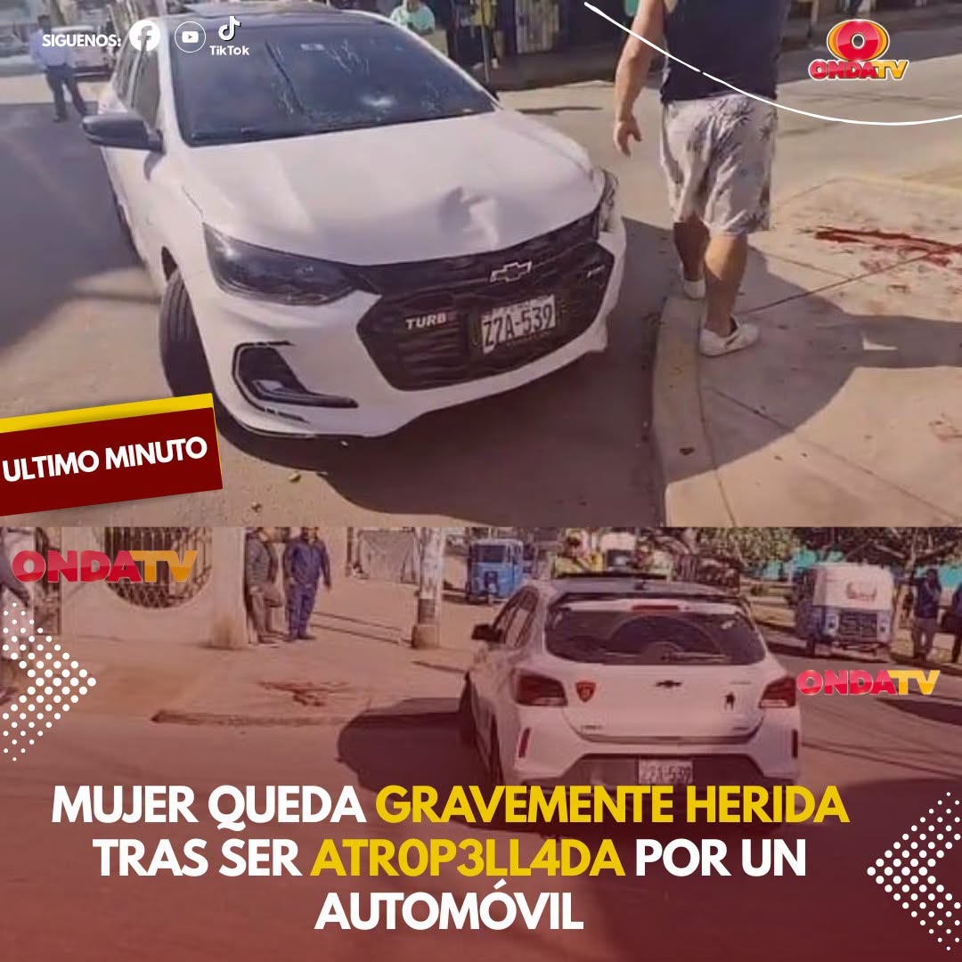 MUJER QUEDA GRAVEMENTE HERIDA TRAS SER ATROPELLADA POR UN AUTOMÓVIL